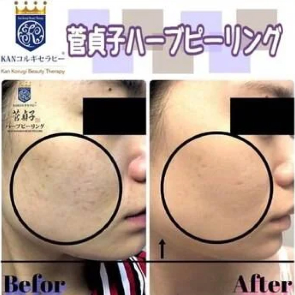 ビフォーアフター